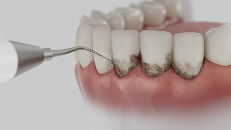 Trusted Teeth Cleaning And Checkup service in Midlothian, TX - Dentist Open Now